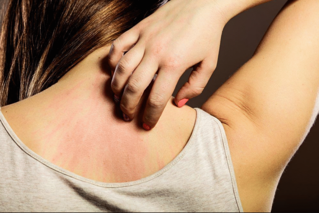Fibromyalgia Itching: Why Your Skin Feels Like It’s on Fire and What You Can Do