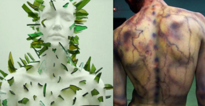 16 Ways to Imagine What Fibromyalgia Disorder Feels Like