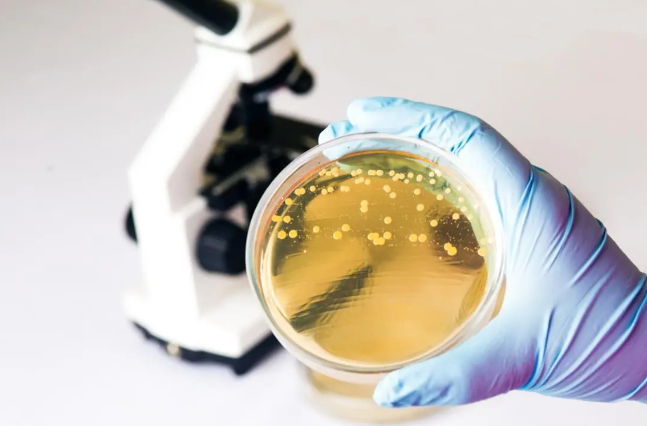 People with fibromyalgia have different gut bacteria