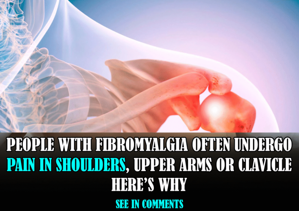 How Common is Clavicle or Shoulder Pain in Fibromyalgia?
