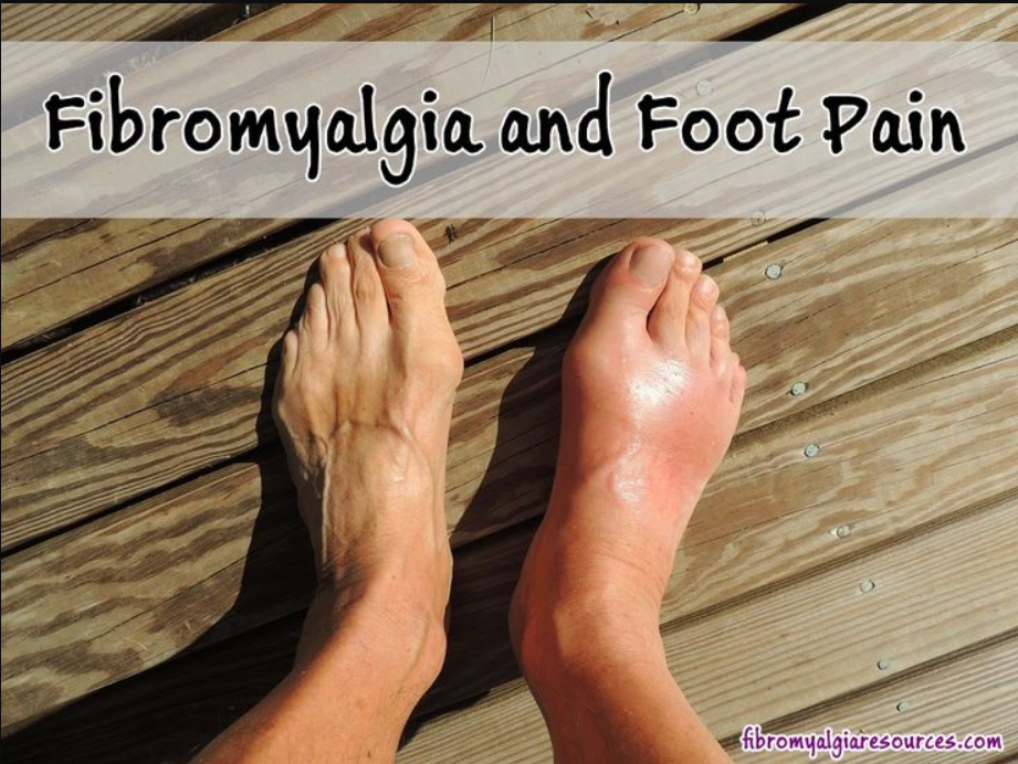 Tips to Control Fibromyalgia Foot Pain