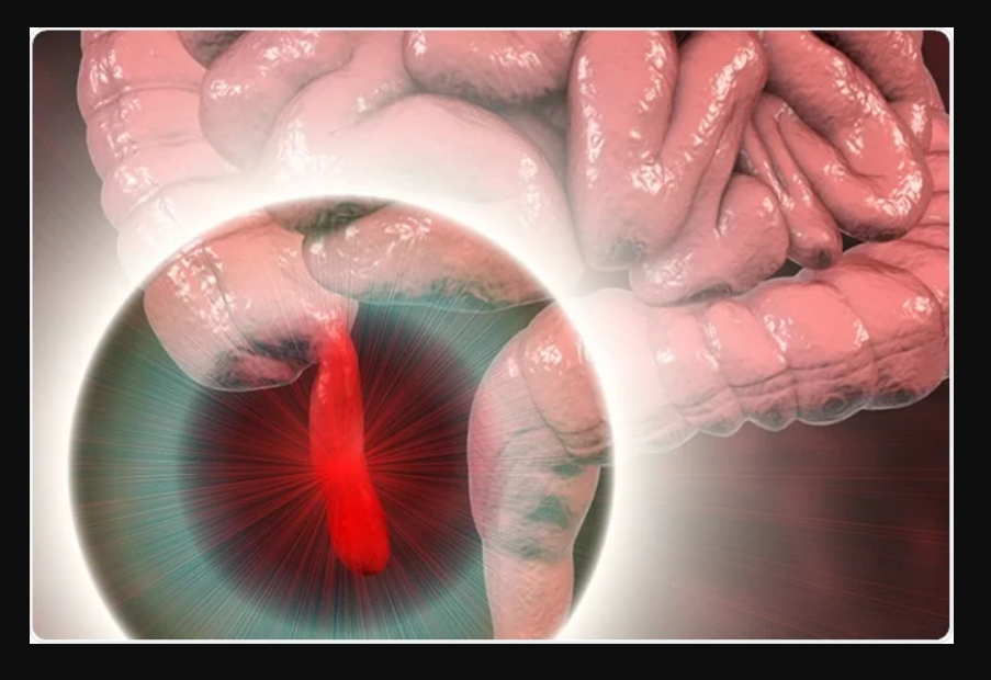 “Chronic Pain: The 20 Most Painful Conditions”